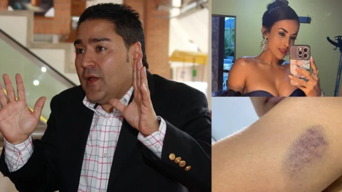 Ana María Balvín denuncia violencia: Ana María Balvín denunció: denuncia contra Misael Cadavid